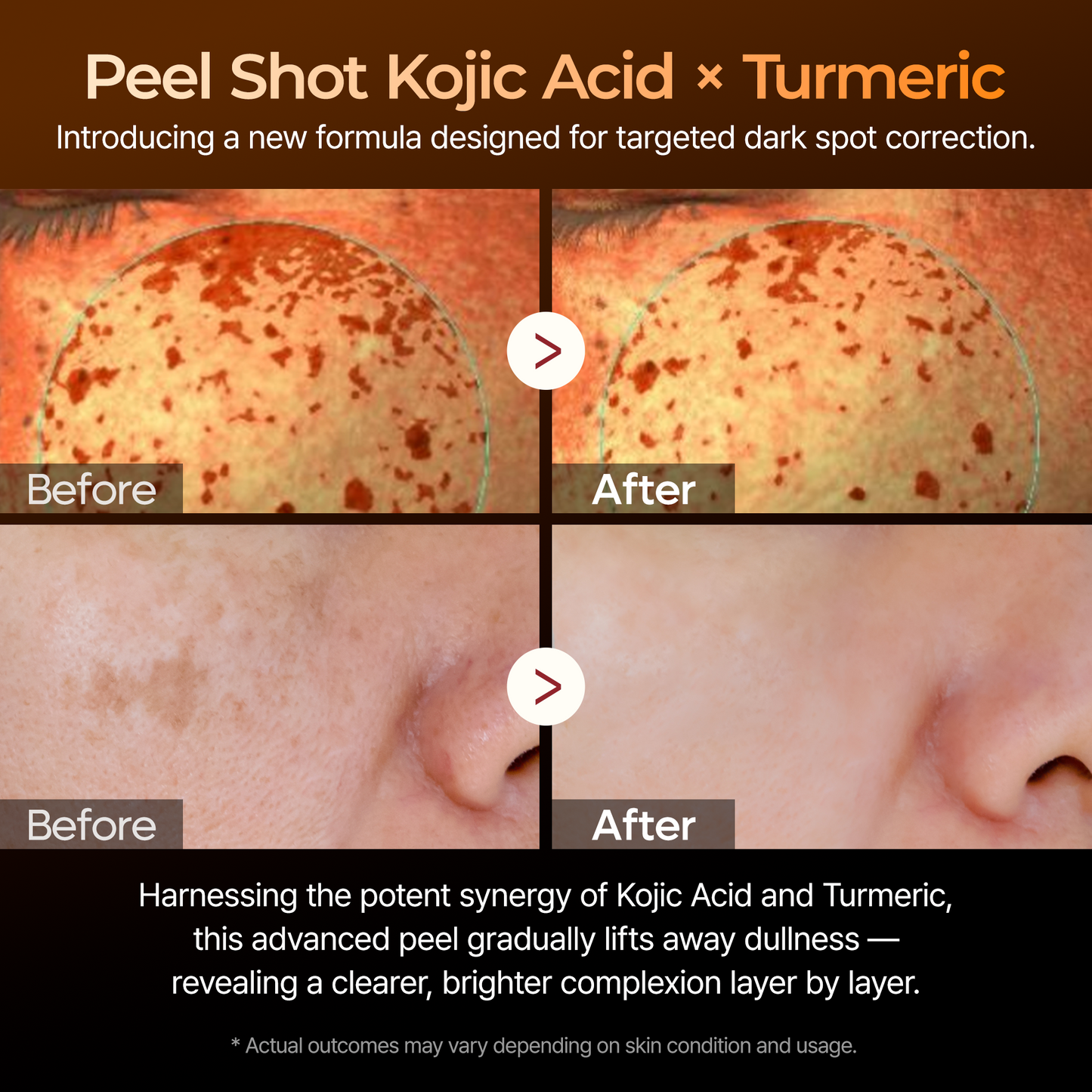 DR MELAXIN - Peel Shot Exfoliating Kojic Acid Turmeric Serum 80ml