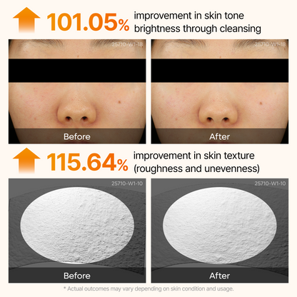 DR MELAXIN - Peel Shot Exfoliating Kojic Acid Turmeric Serum 80ml
