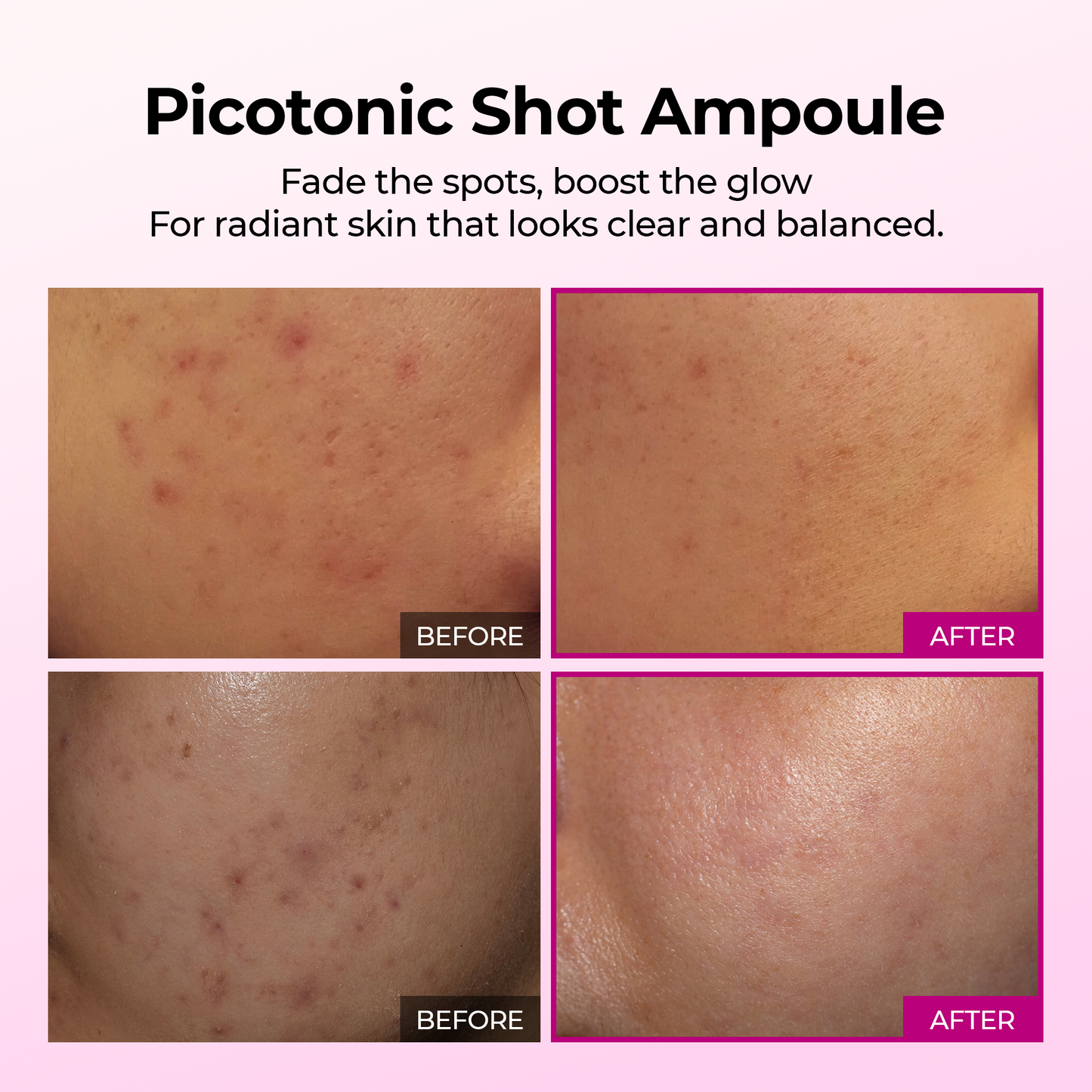 DR MELAXIN - Cemenrete Picotonic Shot Serum 30ml