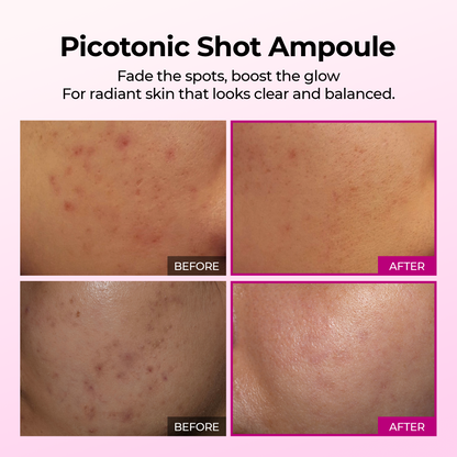 DR MELAXIN - Cemenrete Picotonic Shot Serum 30ml