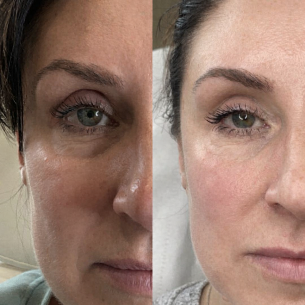 Vegan Collagen Eye Serum