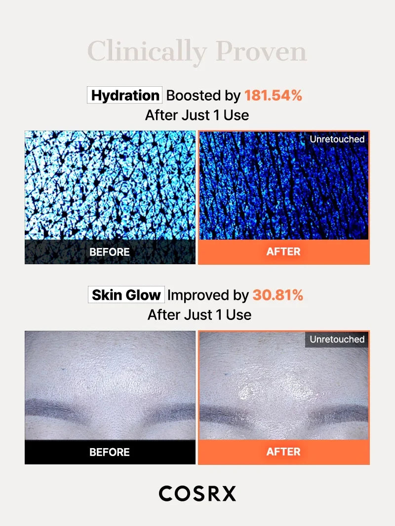 COSRX - 5 PDRN Hyaluronic Acid Vital Hydrating Hydrogel Mask 34g x 3