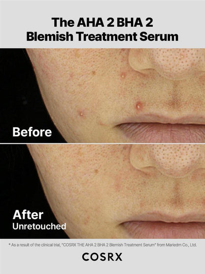 COSRX - The AHA 2 BHA 2 Blemish Treatment Serum 20ml