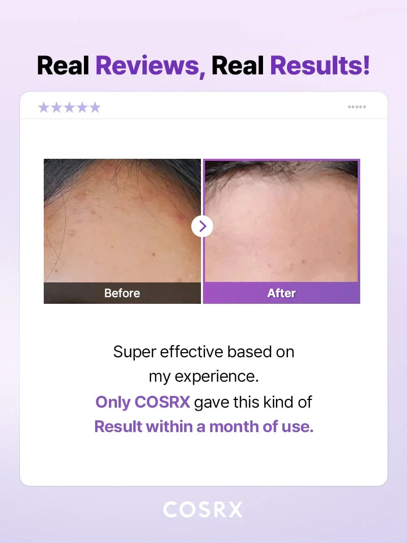 COSRX - AHA/BHA Clarifying Treatment Toner
