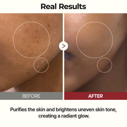 DR MELAXIN - Peel Shot Glow White Rice Toner 200ml