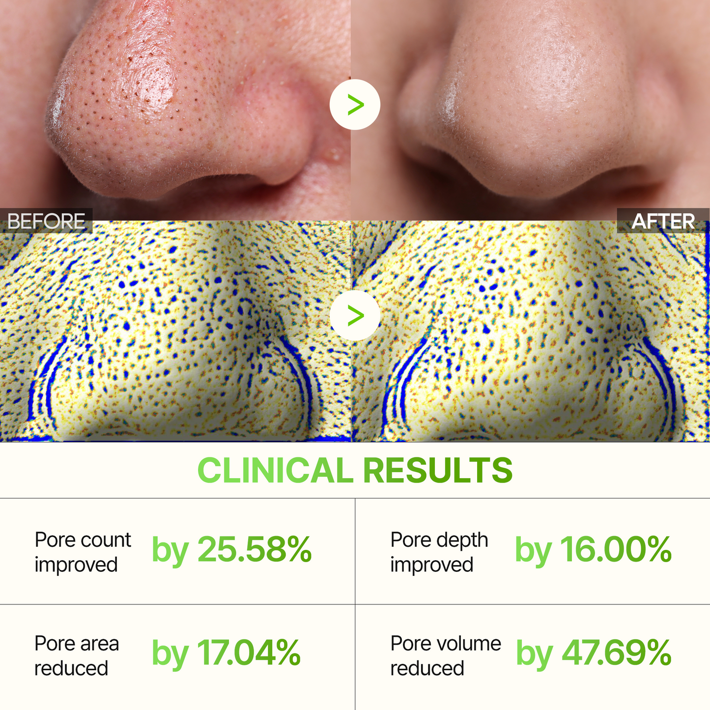 DR MELAXIN - Cactox 3-Step Nose Pore Pack 3gX3ea