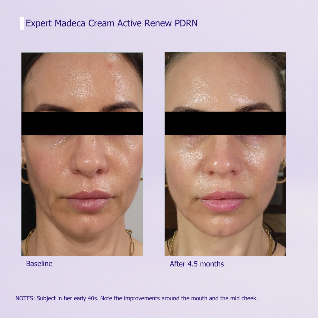 Expert PDRN Firming Cream — Rebuild Elasticity at Any Age