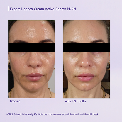 Expert PDRN Firming Cream — Rebuild Elasticity at Any Age