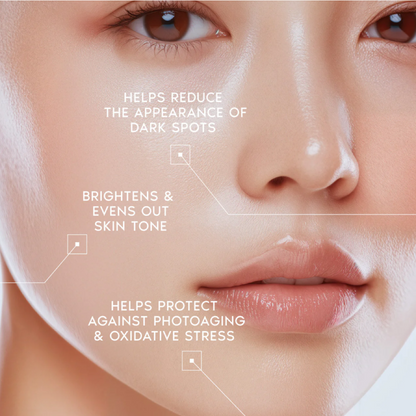 Arbutin 7% + Tranexamic Acid 4% Cream — Buy 2, Get 1 Free