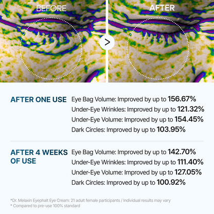 DR MELAXIN - Eyephalt Eyebag Cream 10ml