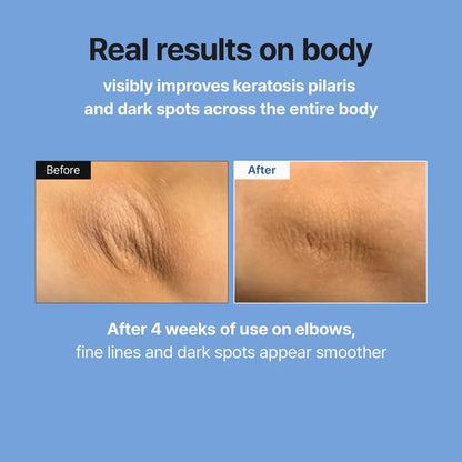 ELVAREA Retinal Skin Booster Serum | Retinal & Niacinamide Complex