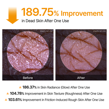 DR MELAXIN - Peel Shot Exfoliating Kojic Acid Turmeric Spray 200ml