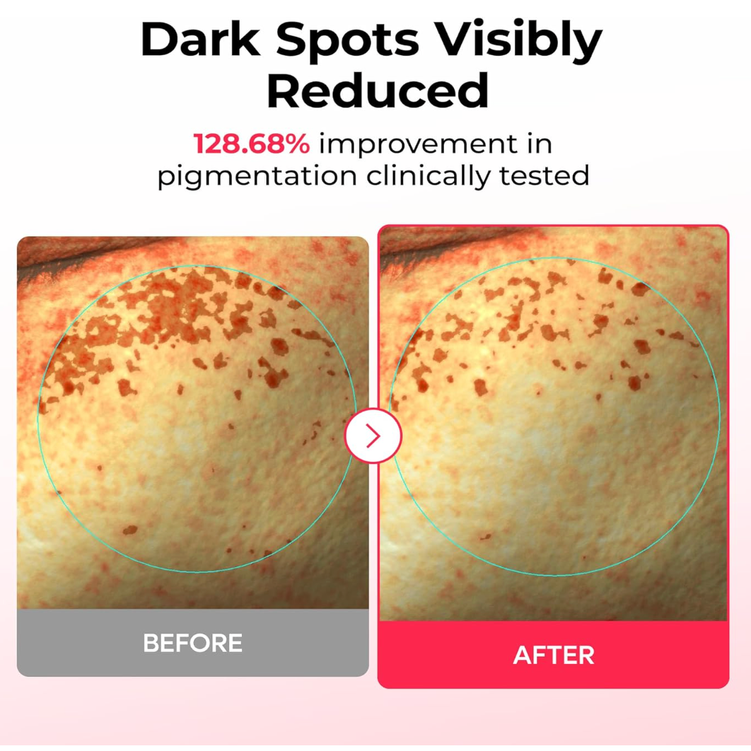 DR MELAXIN - TX-Astaxanthin Dark Spot Care Cream Hydrogel Mask