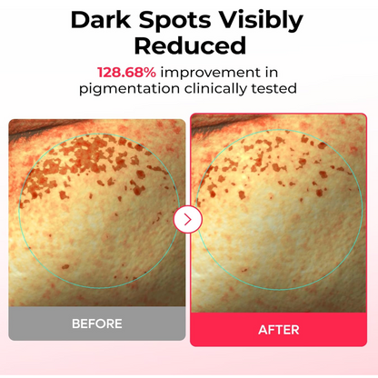 DR MELAXIN - TX-Astaxanthin Dark Spot Care Cream Hydrogel Mask