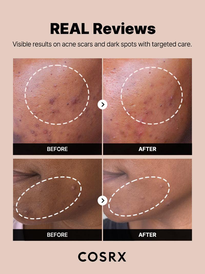 COSRX - The Alpha-Arbutin 2 Discoloration Care Serum 20ml