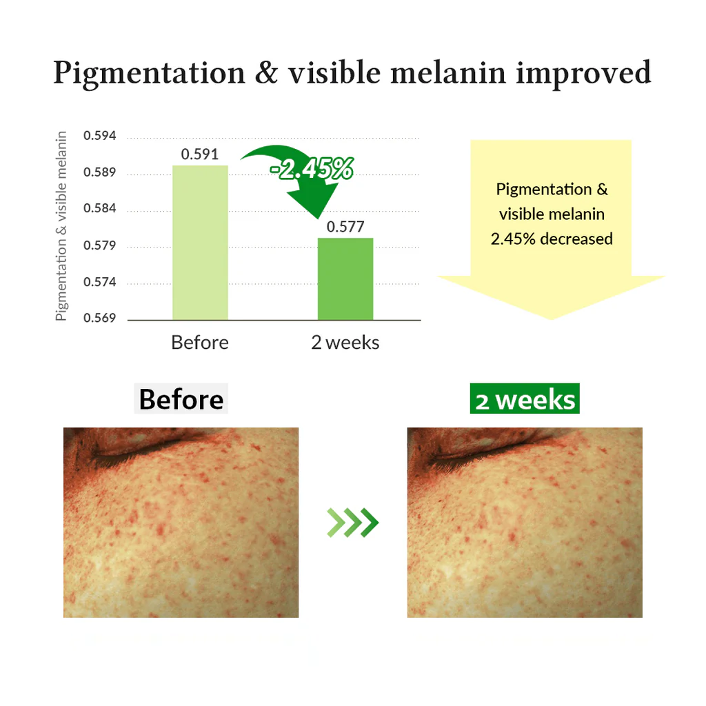Gentle vitamin C serum