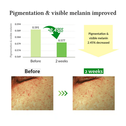 Gentle vitamin C serum