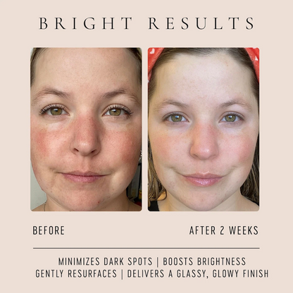 Gentle vitamin C serum