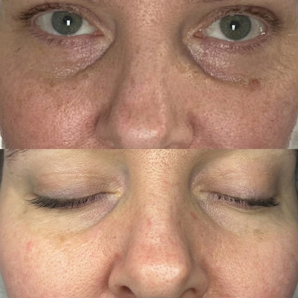 Vegan Collagen Eye Serum