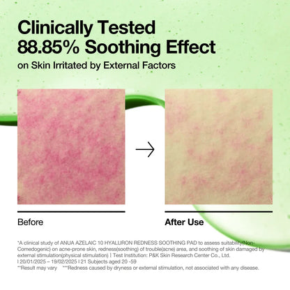 ANUA - Azelaic Acid 10 Hyaluron Redness Soothing Pad 230ml (90 Pad)