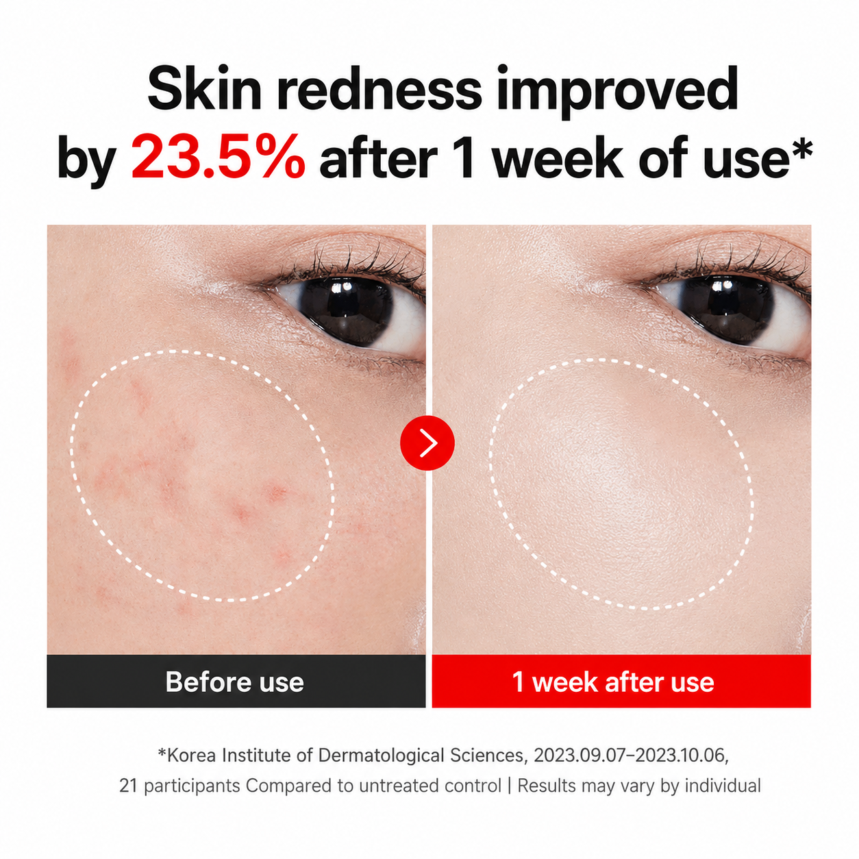 ELVAREA Time Reverse Madeca Cream