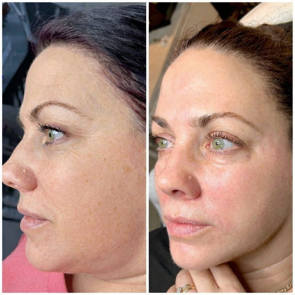 Vegan Collagen Eye Serum