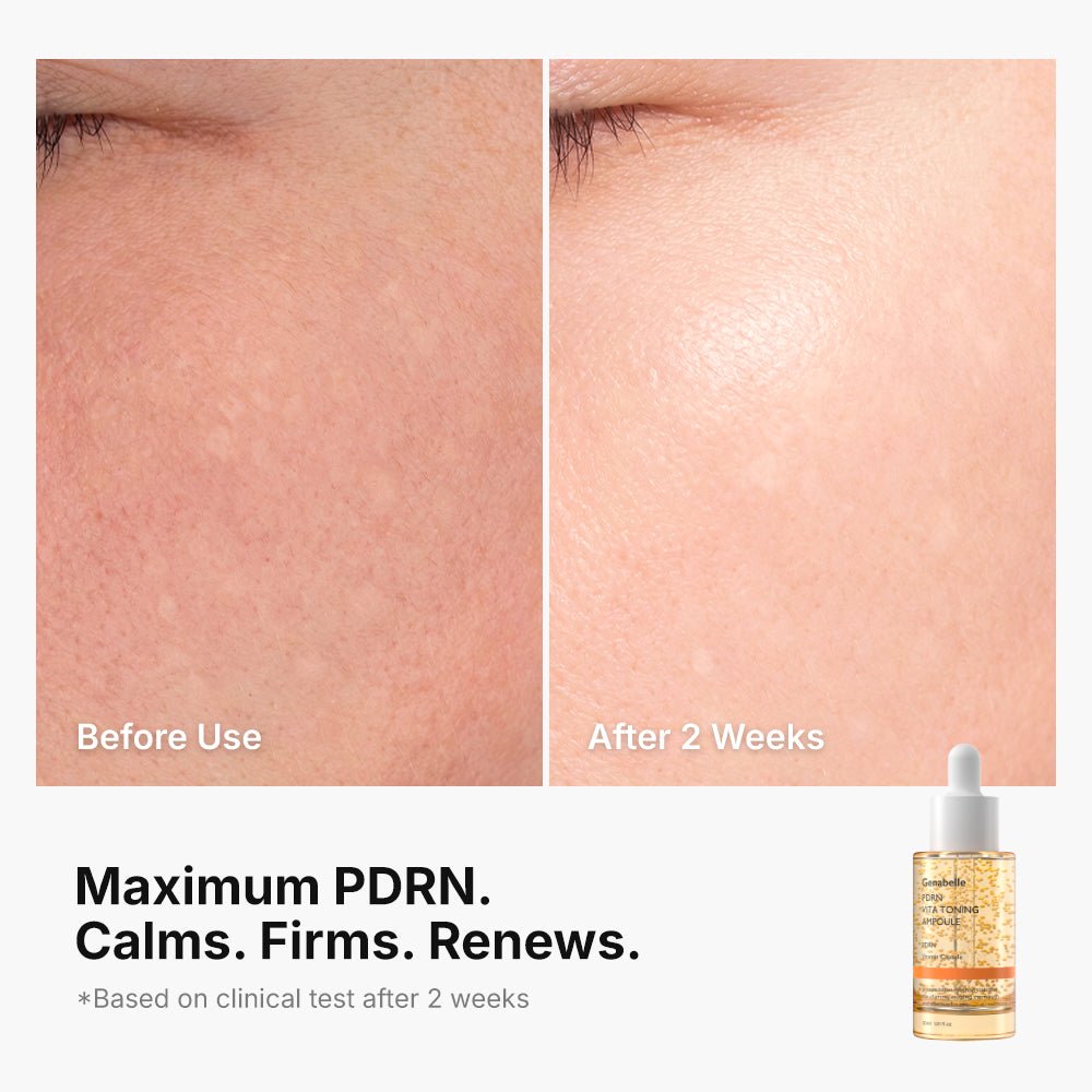 Genabelle - PDRN Vita Toning Ampoule 30ml