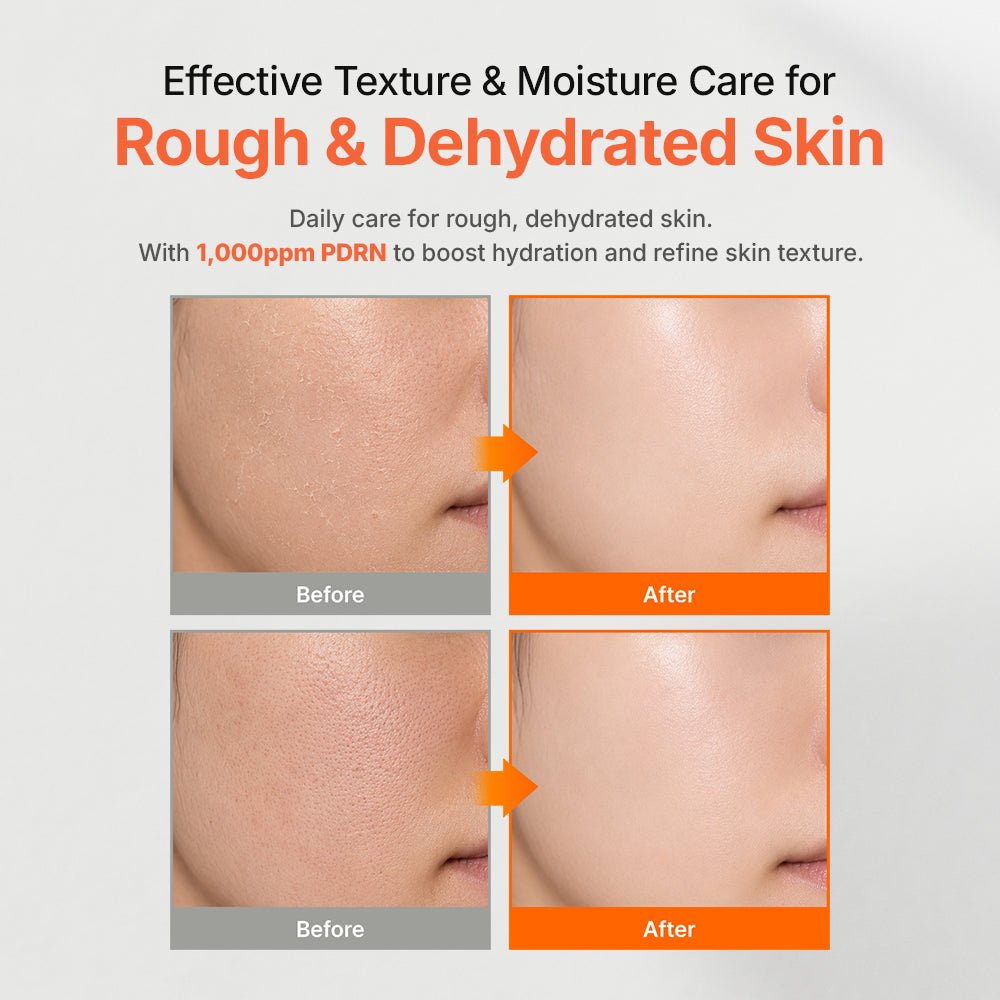 Genabelle - PDRN Rejuvenating Toner 300ml