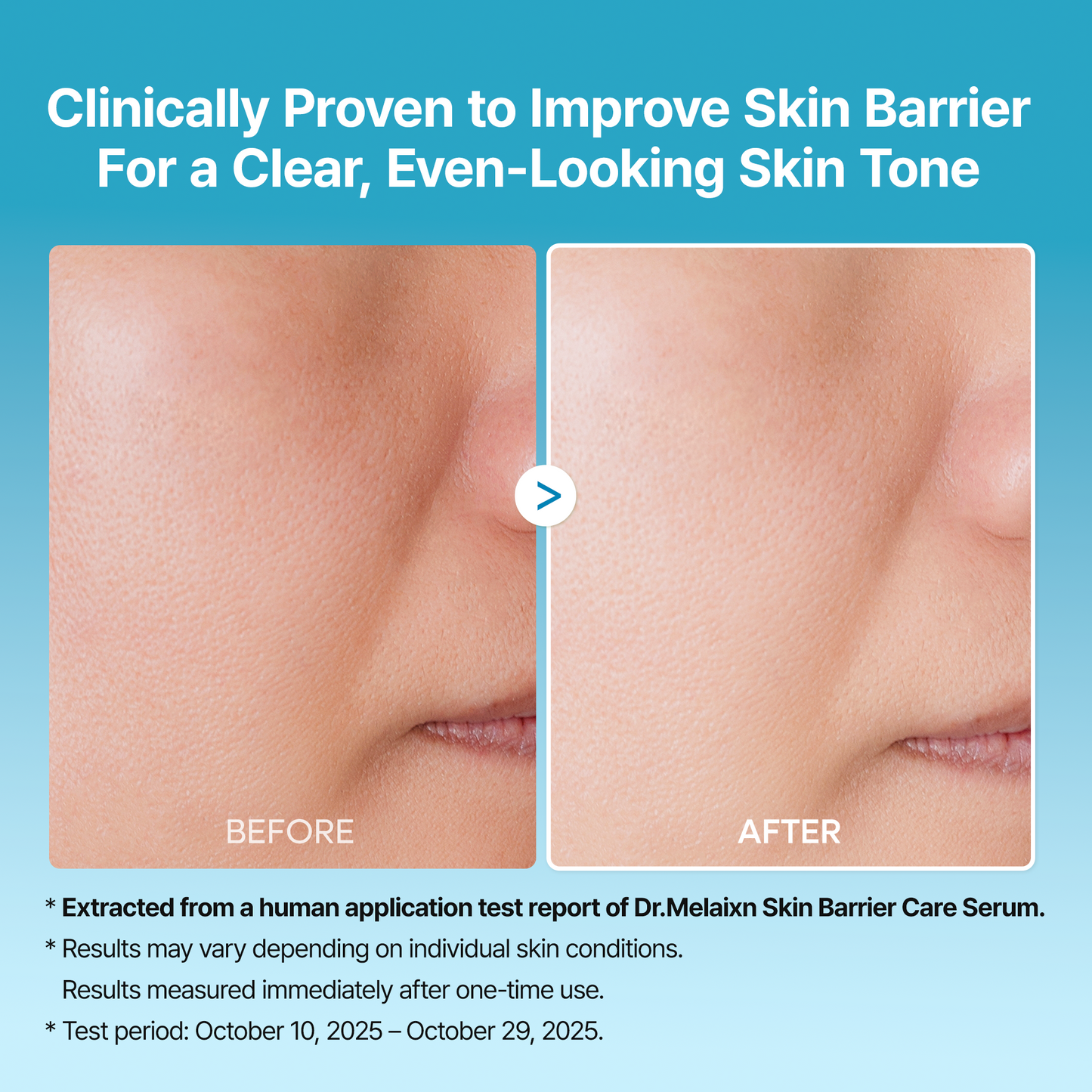 DR MELAXIN - Peel Shot Exfoliating TX-Serum 80ml